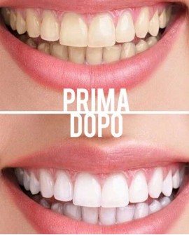 Kit Denti Bianchissimi: dentifricio sbiancante e lip gloss