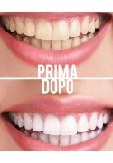 Dazzling White Teeth Kit: whitening toothpaste and lip gloss