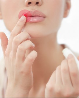 Lip Balm Hyaluronic Herpes