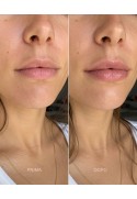 Hyaluronic Volumizer balsamo labbra