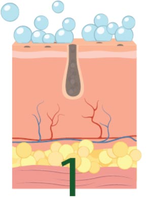 Trattamento specifico contro acne e brufoli