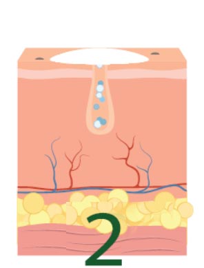 Trattamento specifico contro acne e brufoli